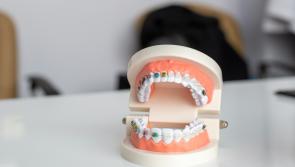 Reports find more than 500 tooth decay cases in Devon
