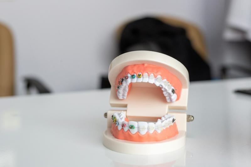 Reports find more than 500 tooth decay cases in Devon