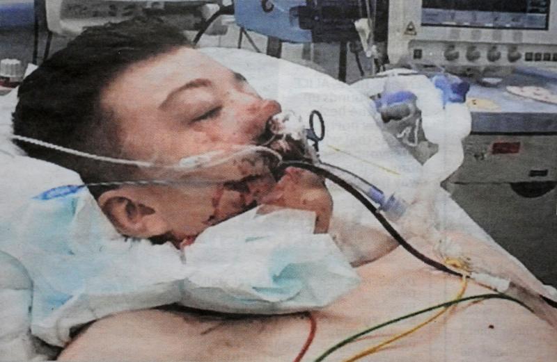 Victims of the Drug Supply Epidemic – A Special Report